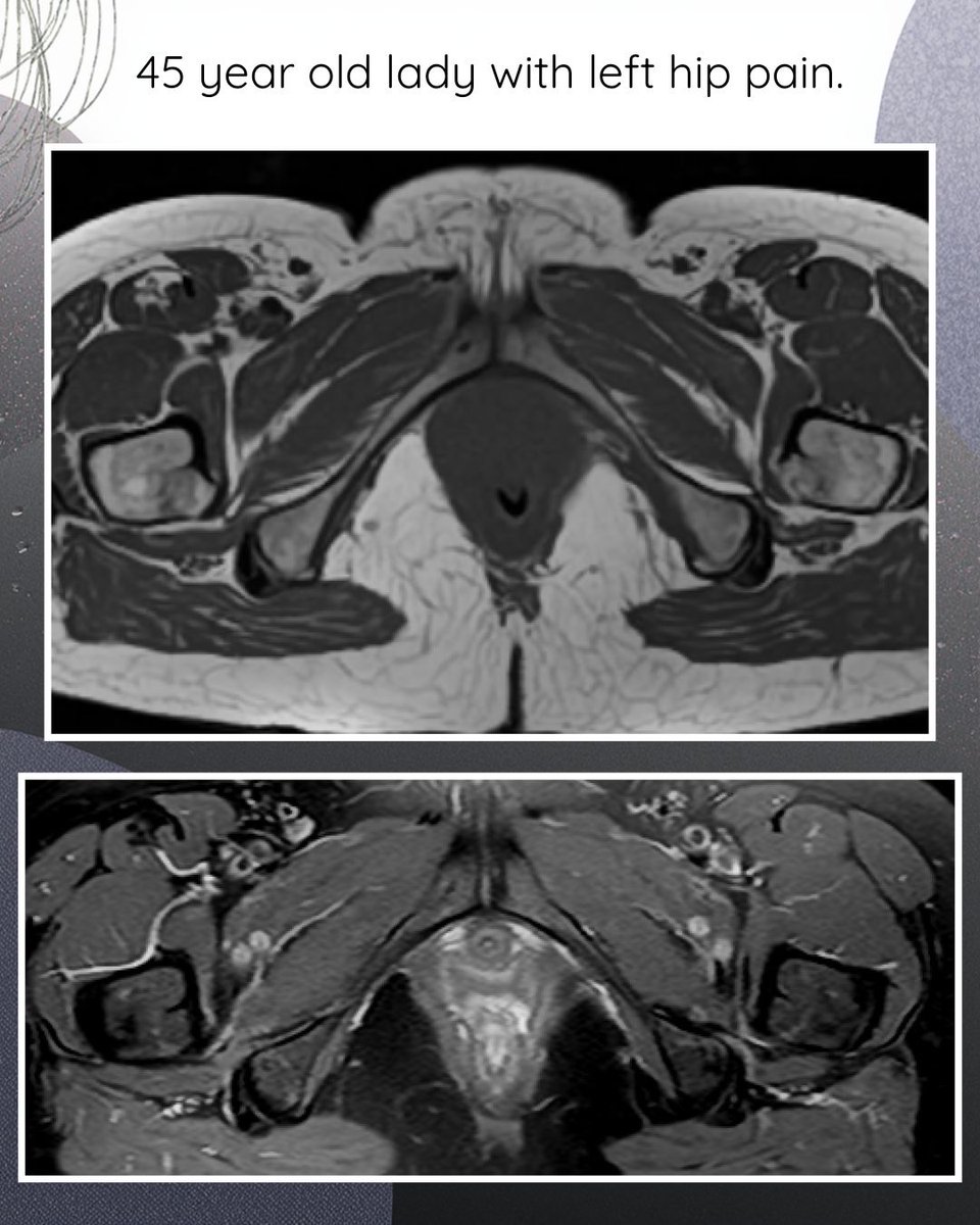 MSS India tweet media