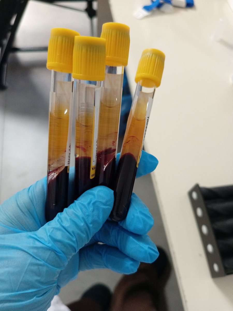 Mesleğimizi severek icra ediyoruz fakat özlük haklarımız olmadan çalışmak bizleri fazlasıyla mağdur etmekte

#EmekVarKadroYok