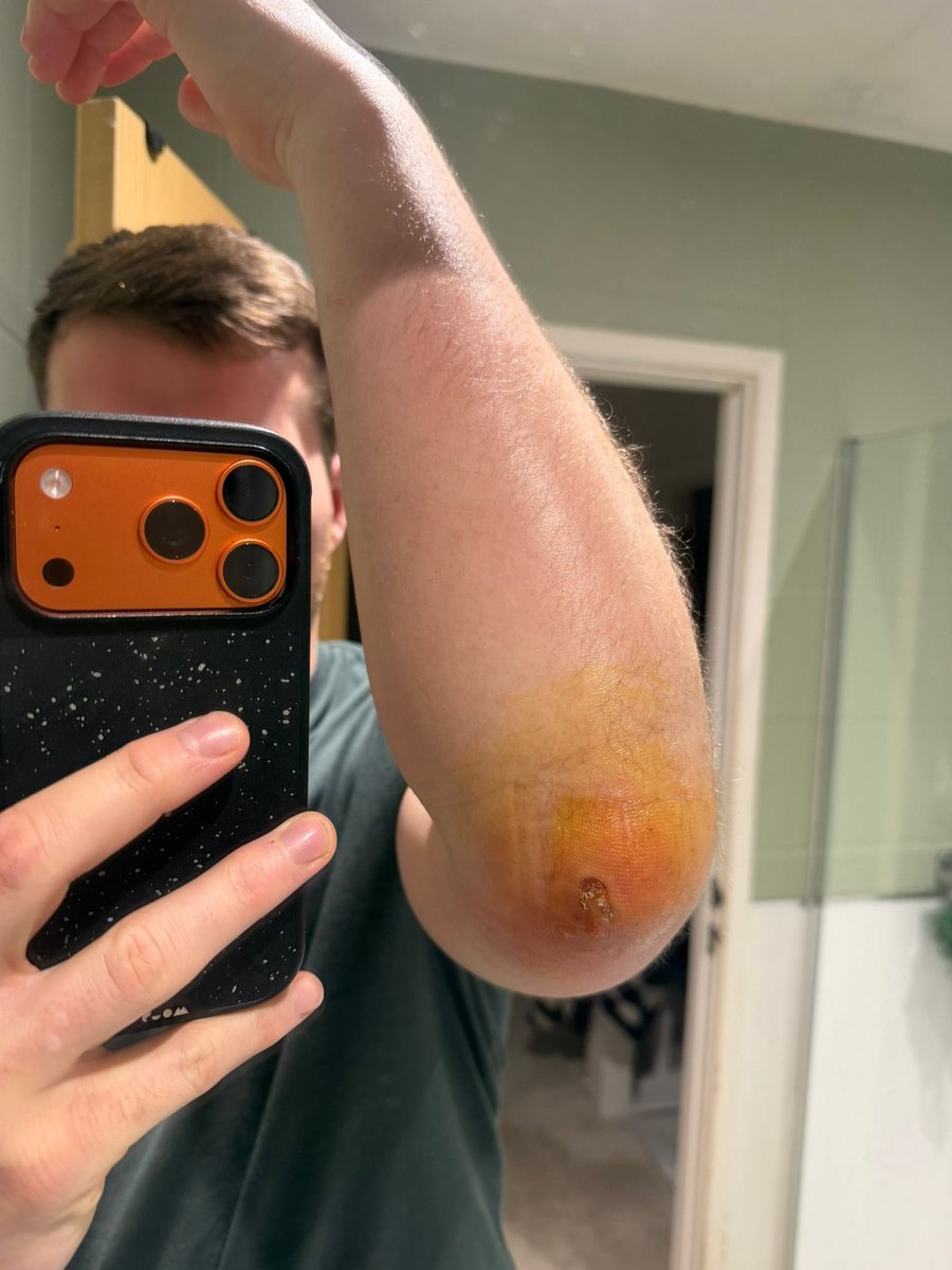 Tondu RFC tweet media