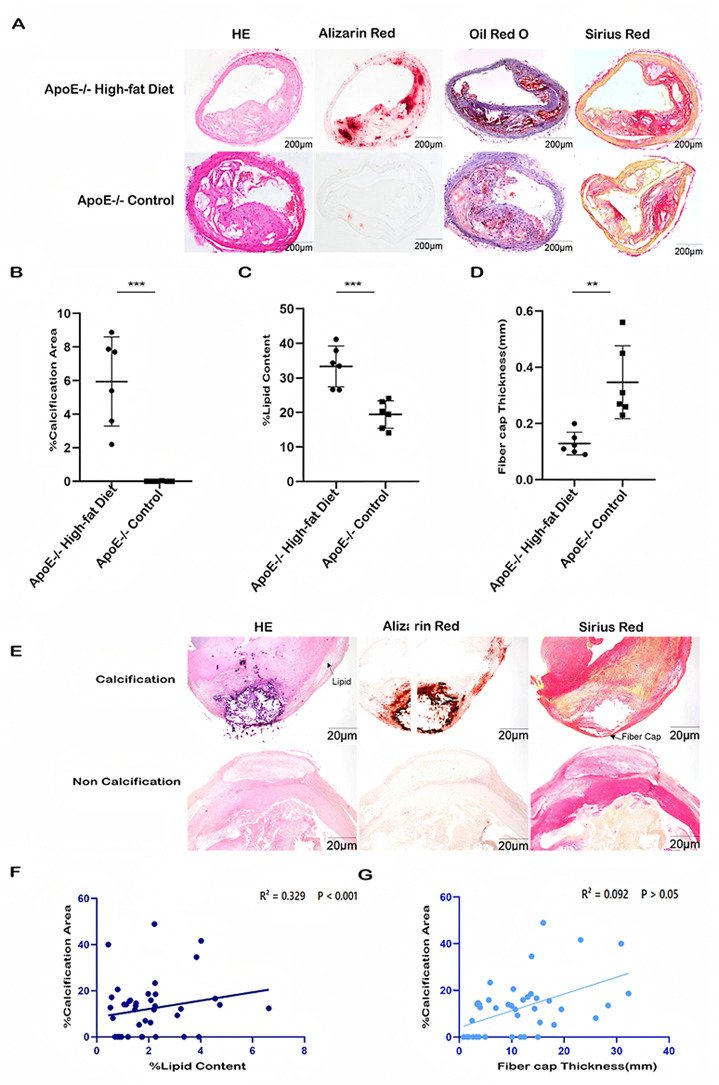 Atherosclerosis Plus tweet media