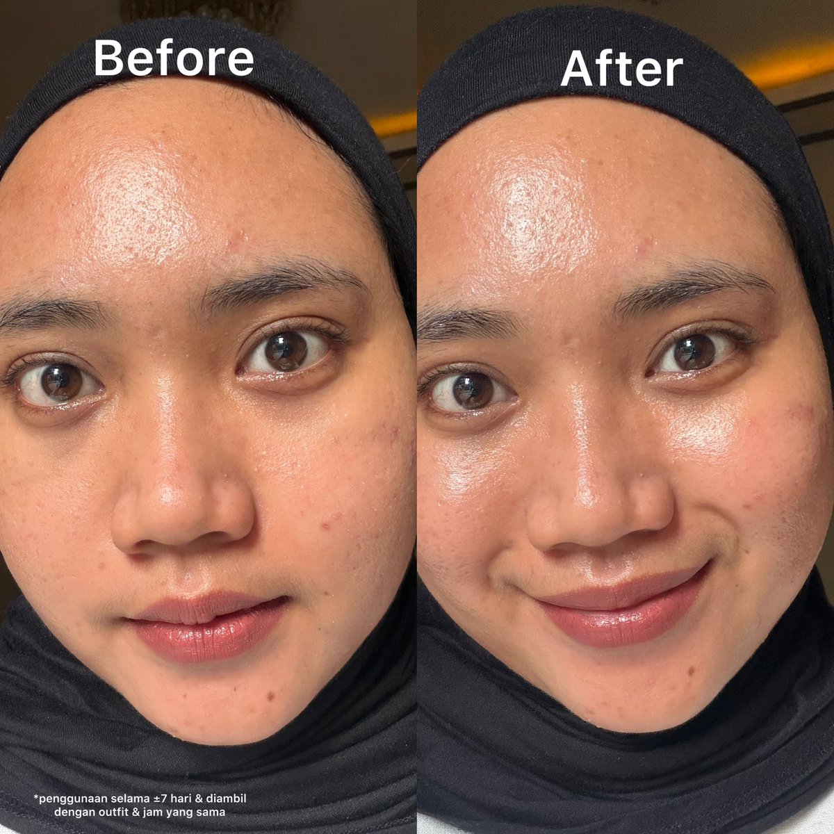 BEST JANUARY PURCHASE SO FAR!!!

Satu produk ini bisa jadi make up primer, face mist dan protective serum yang nyerahinnya GONG BGT

Cocok buat kaum satset dan mendang-mending✨