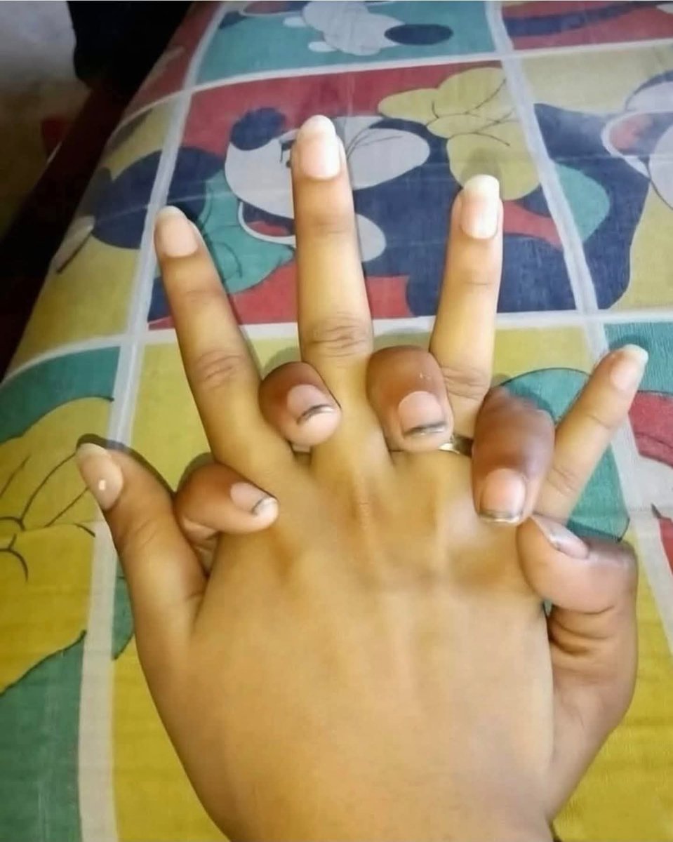 Editores, le pueden arreglar las uñas al novio de una amiga para un mejor recuerdo, por favor