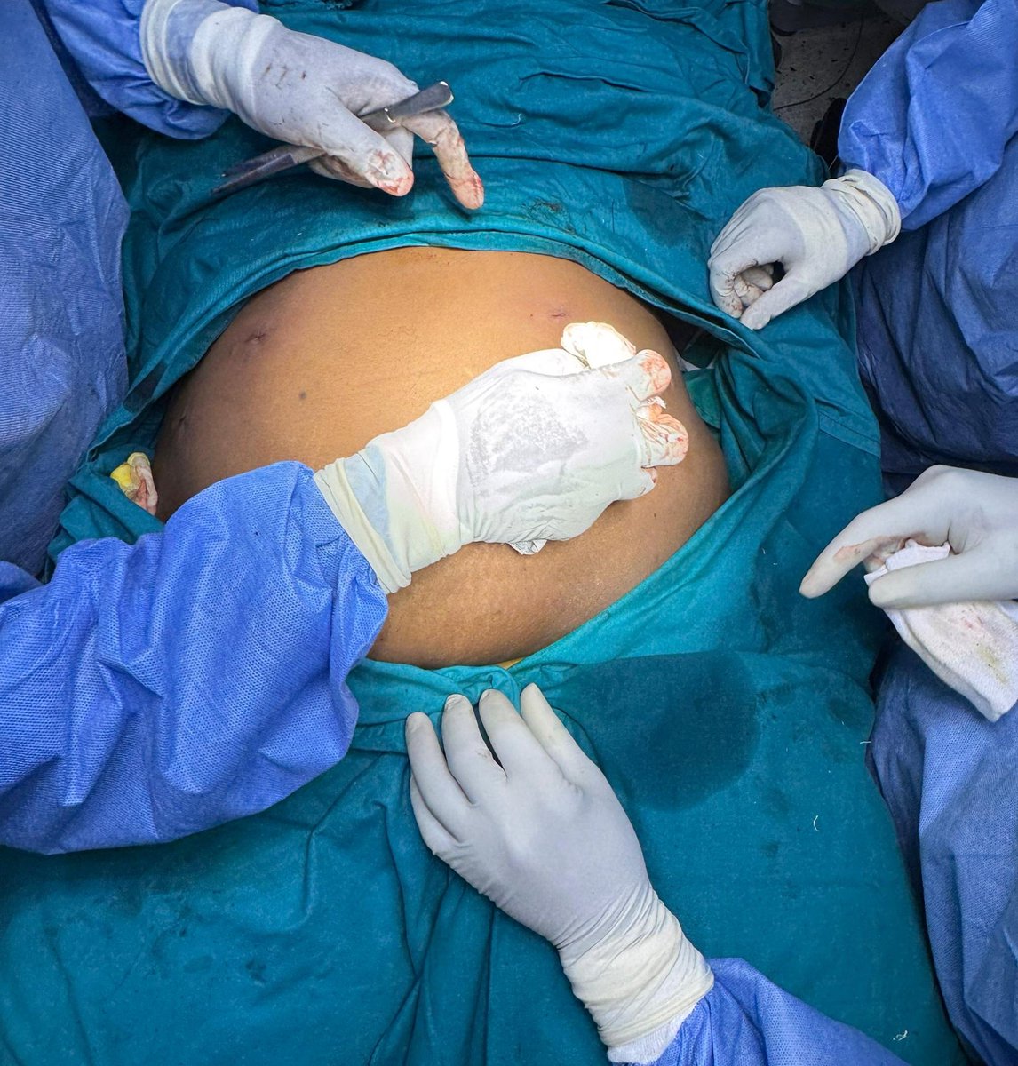 Mengo Hospital tweet media