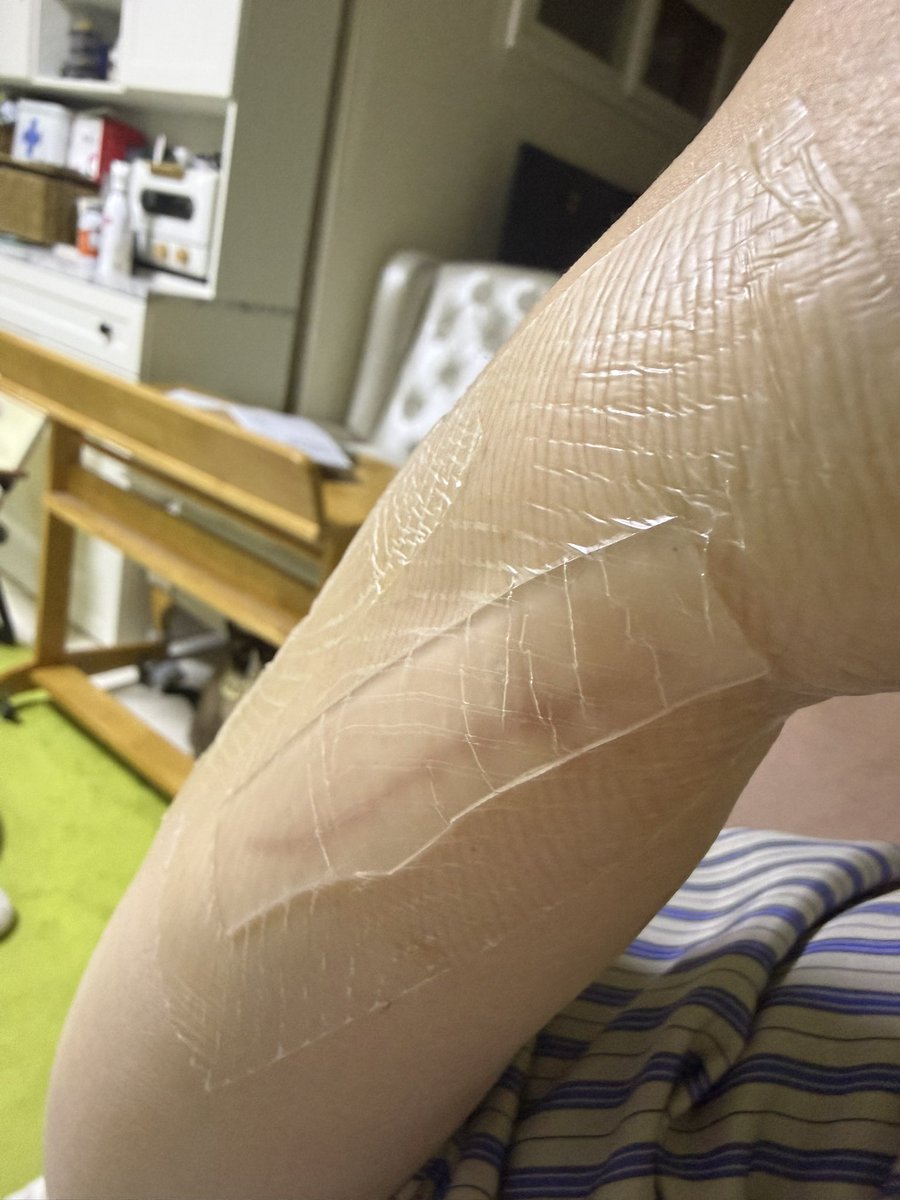 kittysister's tweet image. 선생님들 

고양이가 할퀴었을땐
1. 소독을 잘한다
2. 피부과나 약국을 간다
3. 상처가 아물면 흉터연고-&amp;gt;흉터밴드 순으로

고양이가 물었을 땐
1. 병원으로 직행한다.(저녁엔 응급실 방문)
2. 파상풍 주사를 맞고 소독하고 약을 받는다.
주의: 절대 연고를 바르지 않는다. 안에 세균이 있는데. 겉