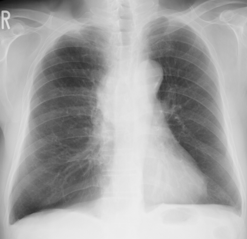 lung-dr | 呼吸器内科医 tweet media