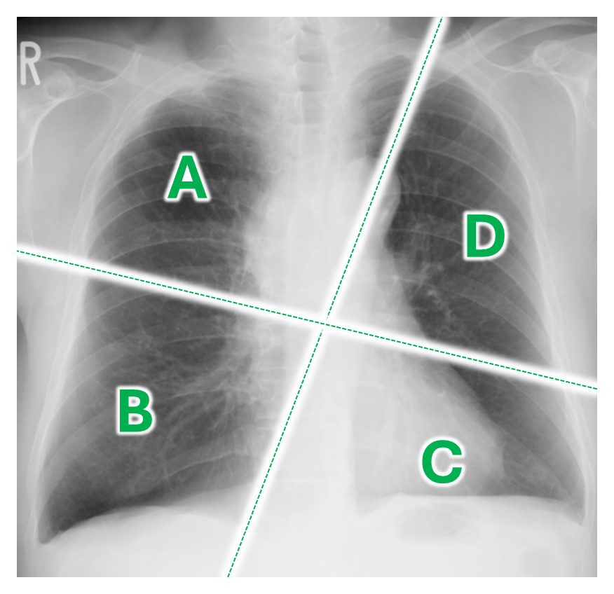 lung-dr | 呼吸器内科医 tweet media