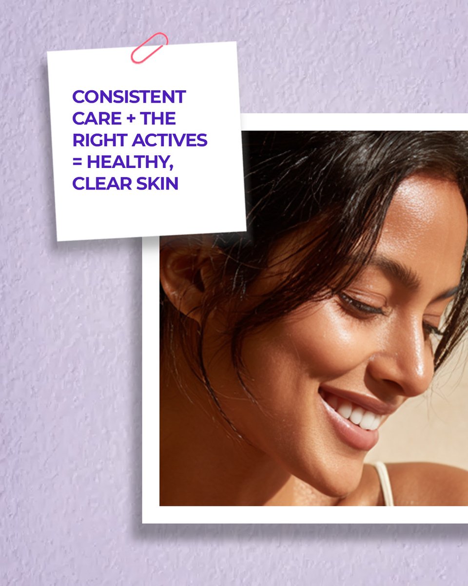 AcnestarGel's tweet image. Good skin isn’t about switching products.
It’s about using the right actives, every morning, without skipping.

#acnestar #acnecare #skincareroutine #clearskinjourney #activeskincare #dermaskincare #skinhealth #acnetreatment #consistentcare #glowingski