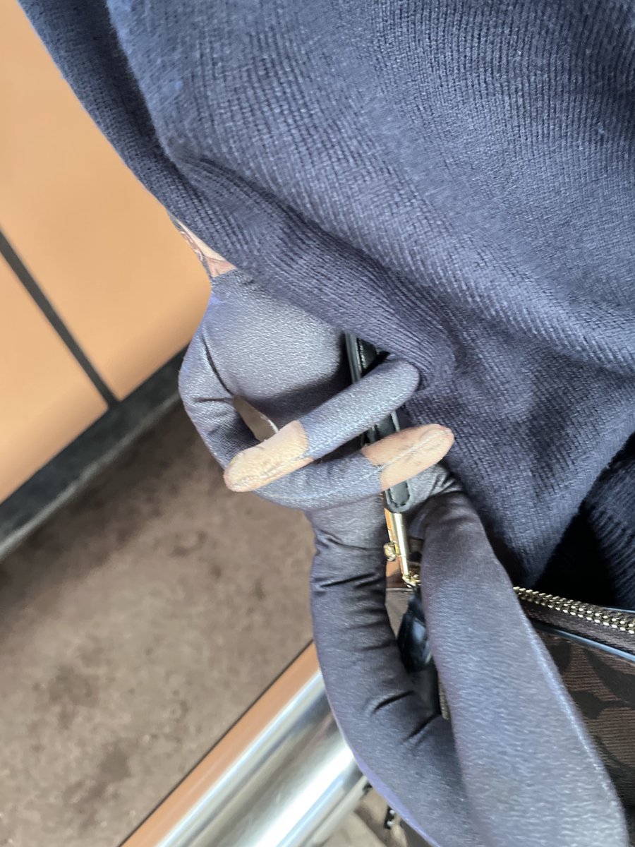 dia tu posisinya emg begini tiap jalan ma ak