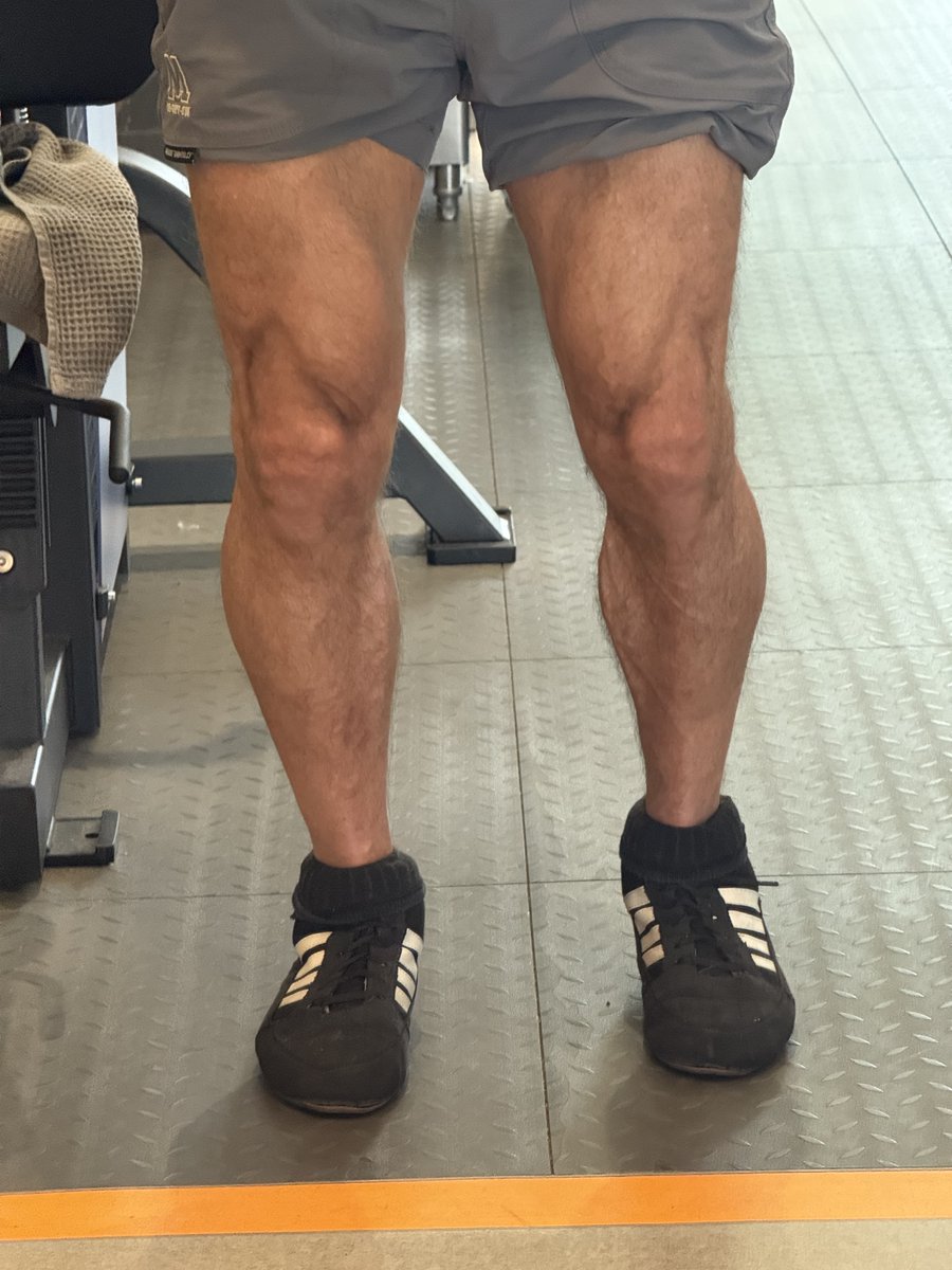 Bvcuma1's tweet photo. @Bartek_Kamyk_ calves... #1 priority https://t.co/k2wpVnhAY4