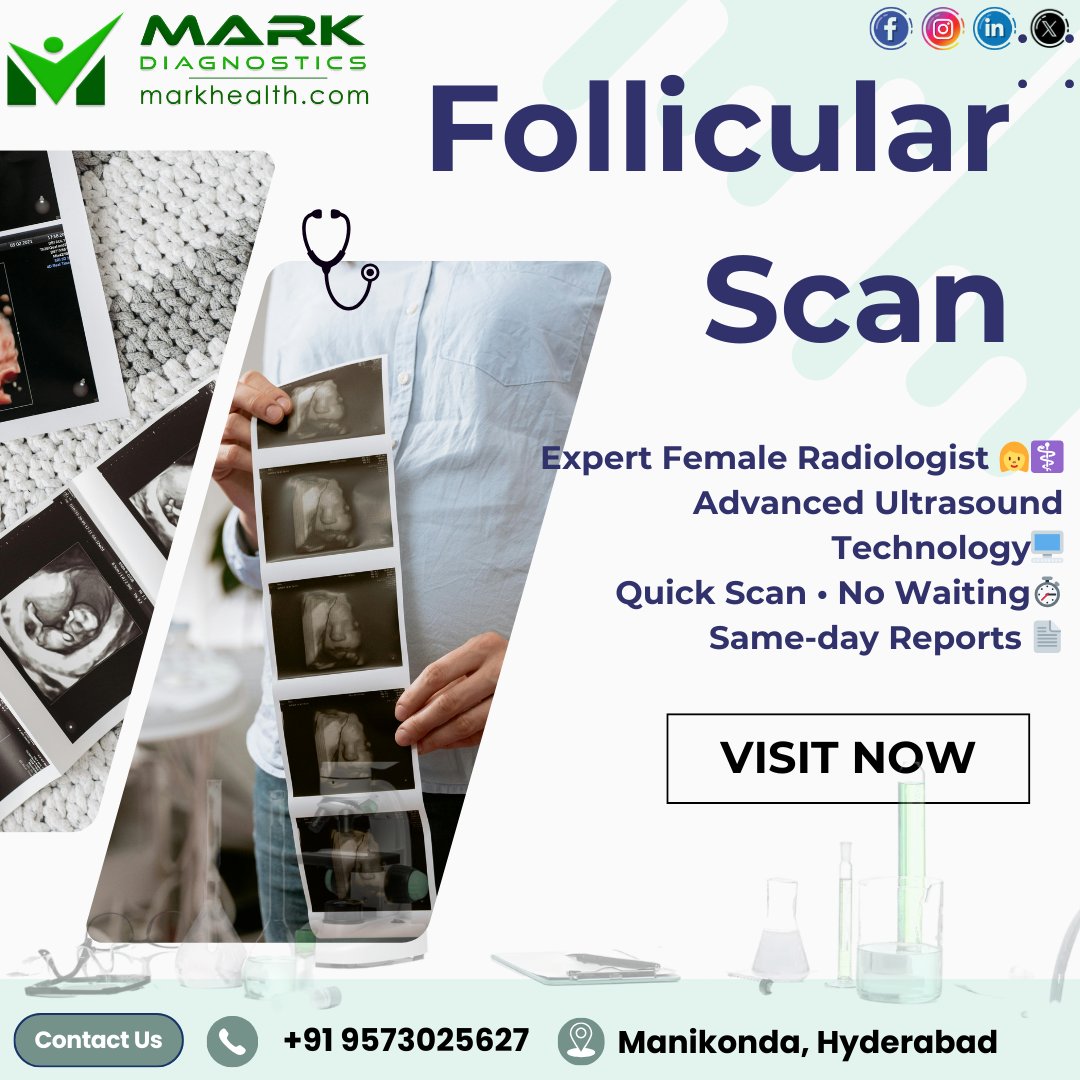 MarkDiagnostics's tweet image. Follicular Scan 🌸
👩‍⚕️ Female radiologist
🖥️ Advanced ultrasound
⏱️ Quick scan • No waiting
📄 Same-day reports
📍 Manikonda, Hyderabad
📞 +91 9573025627
#MarkDiagnostics #HealthCheckup #LabTesting