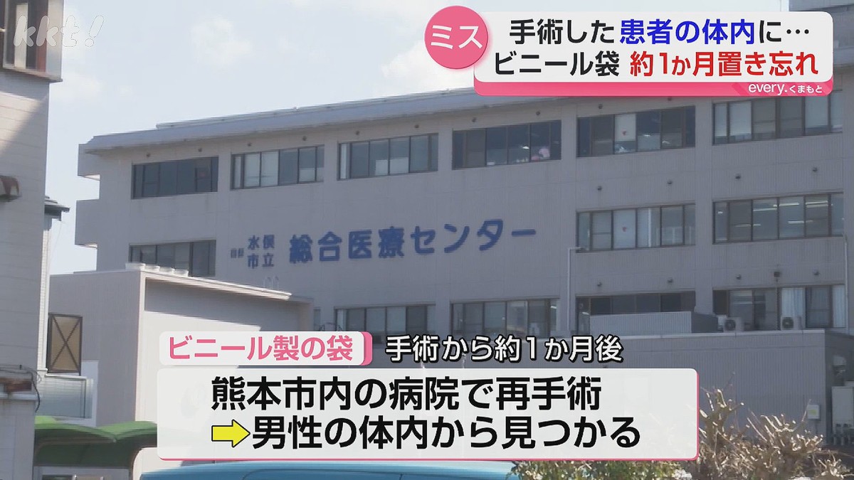 livedoornews's tweet photo. 【医療ミス】体内に手術で使用のビニール袋を置き忘れ、約1カ月後に腹部痛みで発覚 熊本
https://t.co/Zf5rbQa3KW

2023年8月、50代男性に虫垂炎の手術をした際、体内に入れた袋を置き忘れたという。袋は縦15センチ、横10センチほどの大きさで、丸まった状態で体内に残っていたとのこと。 https://t.co/qBd69yLEHD