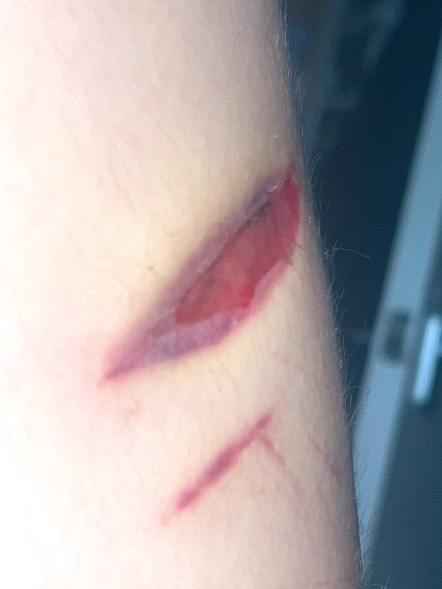 IHATE THIS STUPID CUT