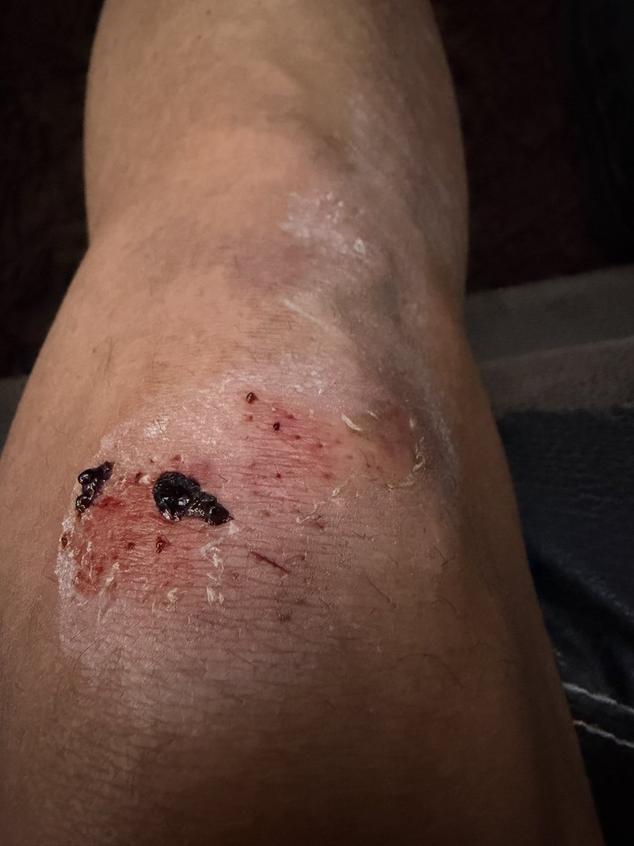 Ayuden a hacer famoso al de este Logan blanca, que hoy me atropello, y ni suquiera freno…, trabaja en el <a href="/PriceSmartco/">PriceSmartco</a> de la Autonorte cc <a href="/DianAngel01/">Diana Angel</a> <a href="/MalaMMujer/">Mala Mujer</a> <a href="/MafeCarrascal/">Mafe Carrascal Rojas</a>