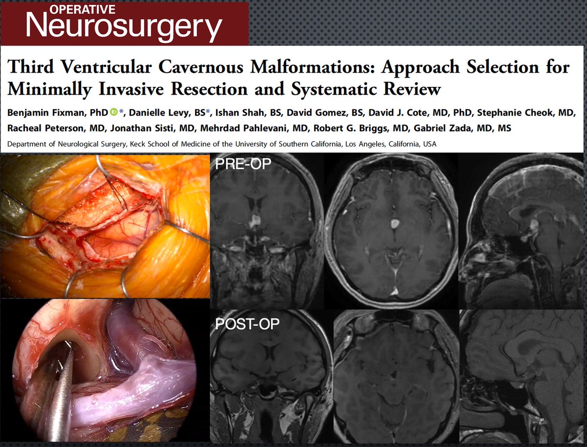 Gabriel Zada, MD, MS tweet media