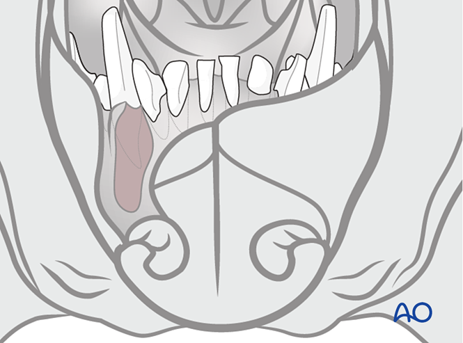 AO Surgery Reference tweet media