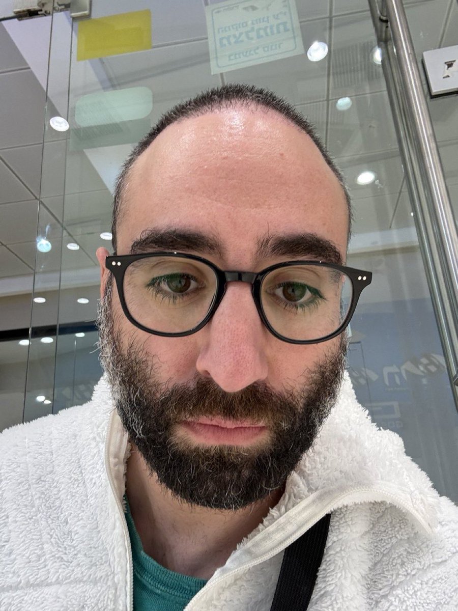 Before and after of a CT victim who bought and held every Lexapro bundled scam this week.