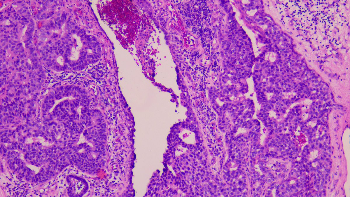 Kenny De Gracia T. tweet media