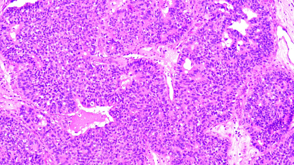 Kenny De Gracia T. tweet media