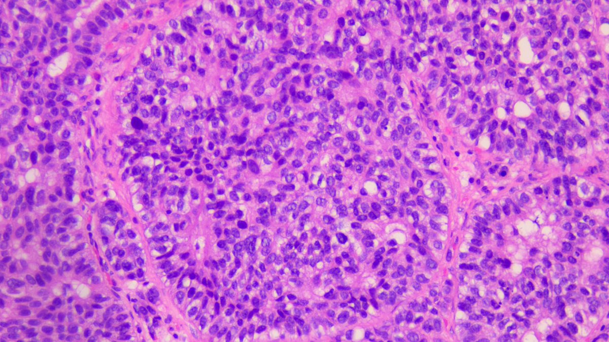 Kenny De Gracia T. tweet media