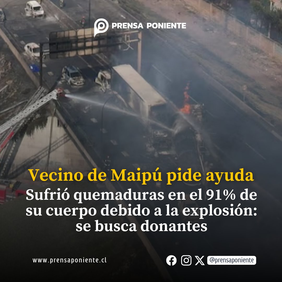 #Ayuda para vecino de Maipú con graves quemaduras tras explosión 

Durante la explosión de Renca, hubo un vecino de Maipú gravemente afectado.

Se trata de Luis Gustavo Romero, quien resultó con el 91% de su cuerpo quemado por la explosión. 

Actualmente se encuentra en coma