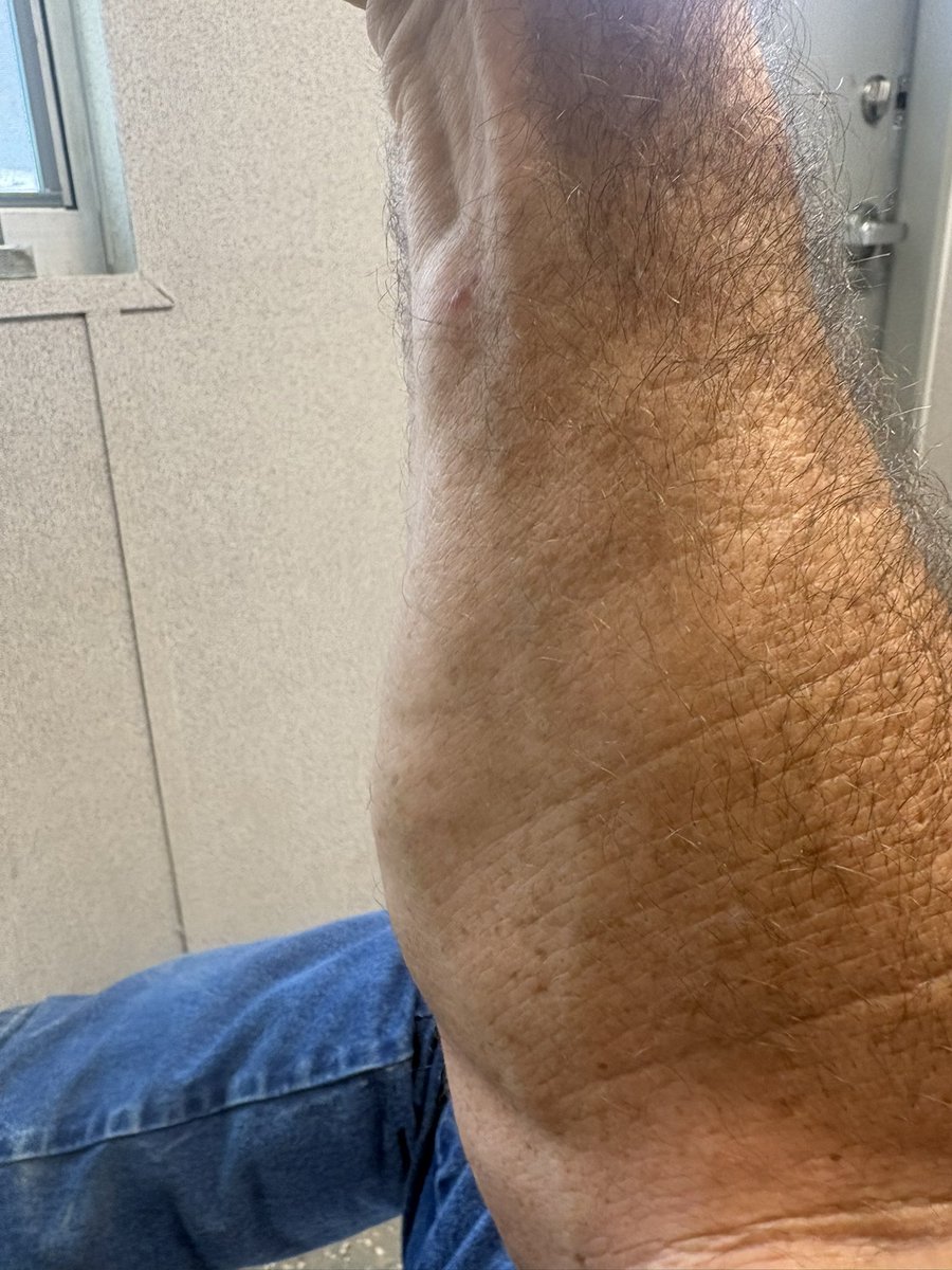 💯 Chuck 💯 tweet media