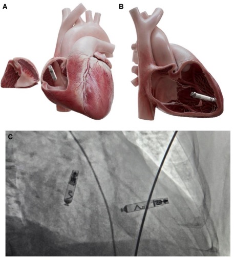 Europace Editor-in-Chief tweet media