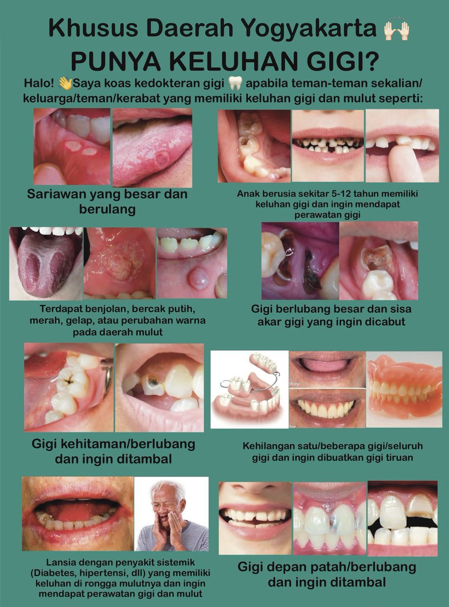 KOAS GIGI JOGJA💅🏼 tweet media