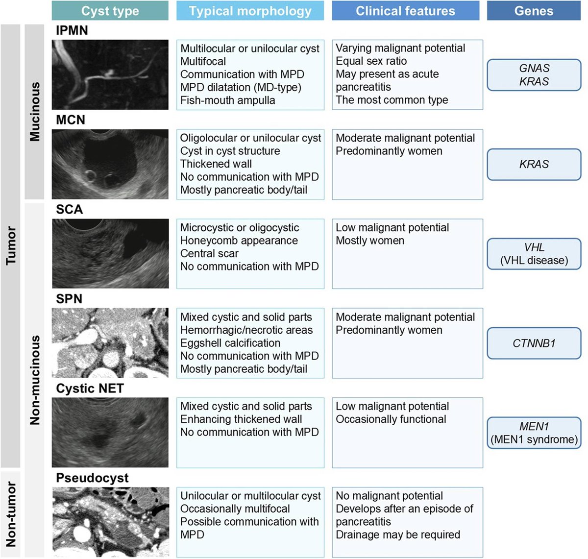 Intraductal Papillary Mucinous Neoplasm and Pancreatic Cancer: Opportunity Knocks Twice
Hamada, et al.

📕 doi.org/10.14309/ajg.0…

<a href="/YousukeNak54193/">Yousuke Nakai 中井　陽介</a> <a href="/MLongMD/">Millie Long</a> <a href="/JasmohanBajaj/">Jasmohan Bajaj</a>