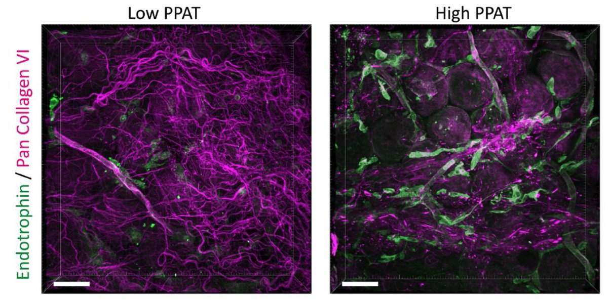 UTSWdiabetes tweet media