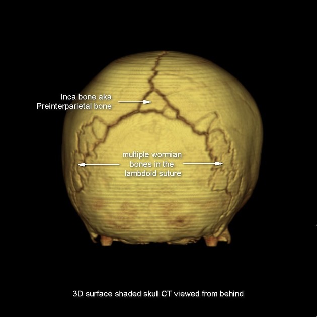 Nazca Mummies tweet media
