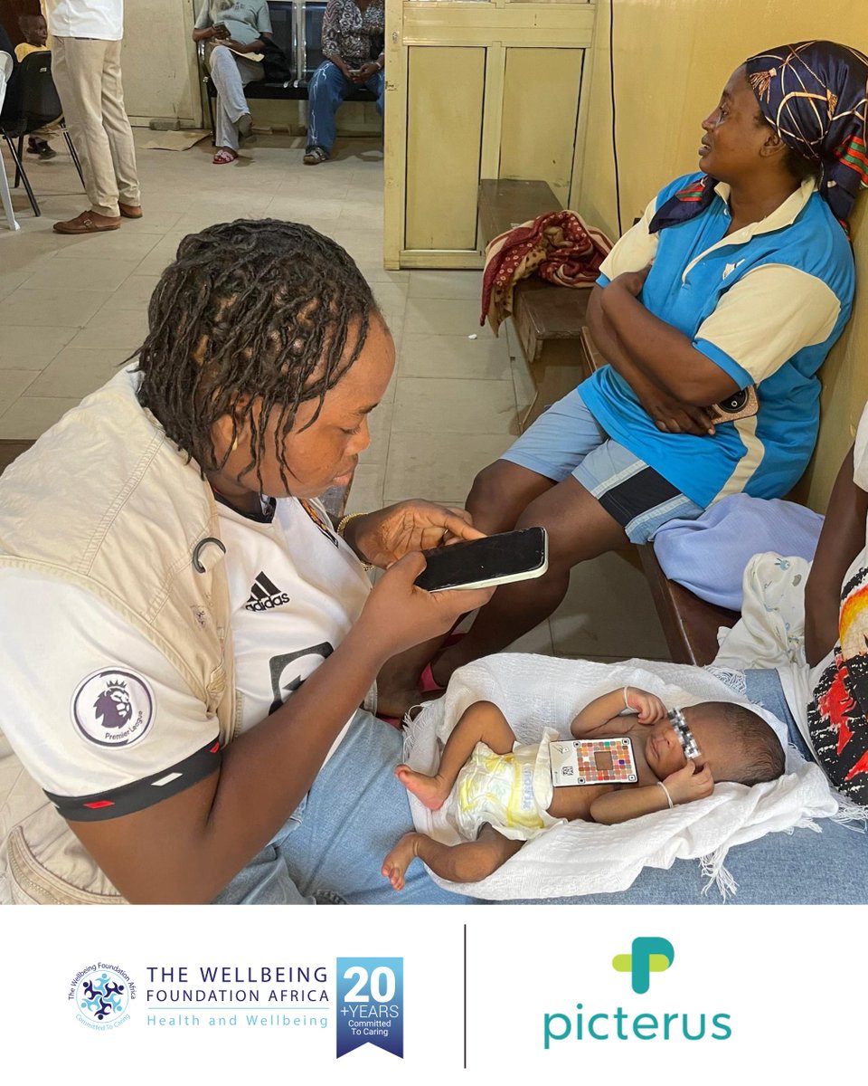 I welcome this collaboration with Picterus, which strengthens our work at the @WellbeingAfrica Foundation under Project Oscar – Light for Life by advancing early detection and timely management of neonatal jaundice. By embedding non-invasive digital screening into routine
