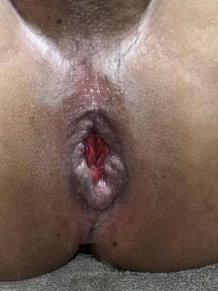 Orgulloso de mi avance 😍 #anal #rosebud #extreme
