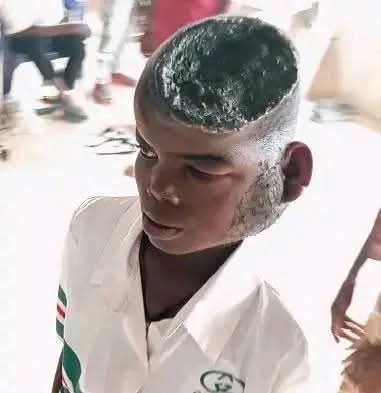 This isn't Photoshop, it's not AI, it's real, at first, I saw and doubted it until I reliably confirmed.

What sort of ailment is this? And why are they busy moving from one man and woman of God to another instead of going to a hospital?

You can imagine the pains this boy is