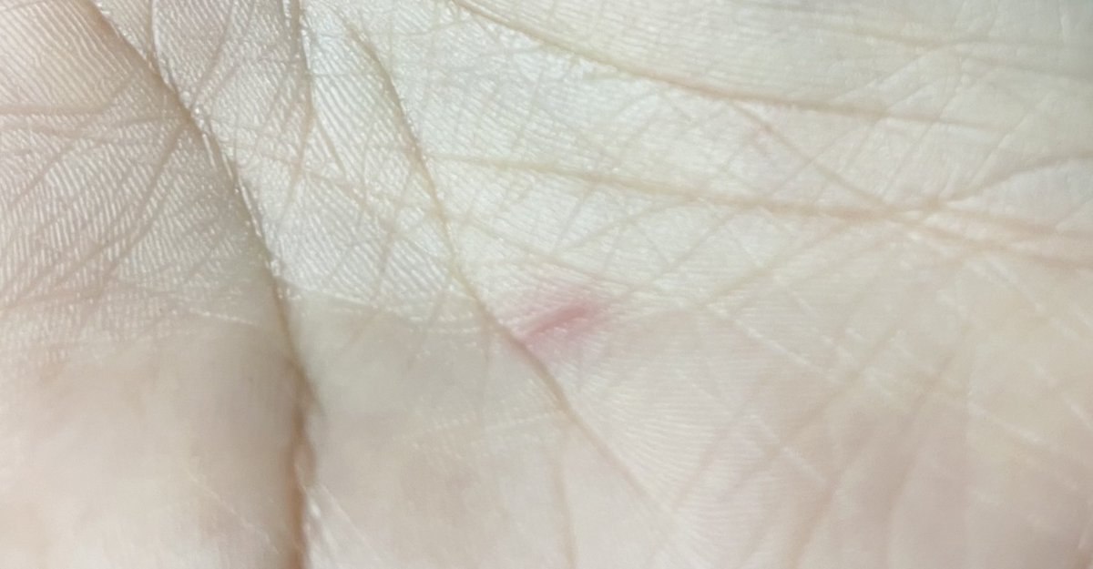 Romantic 🥥 tweet media