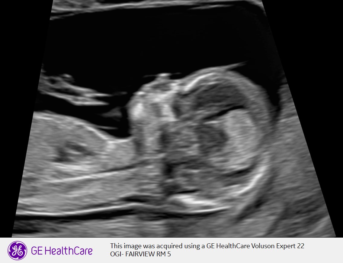 Pissed Browns Fan🇺🇸 tweet media