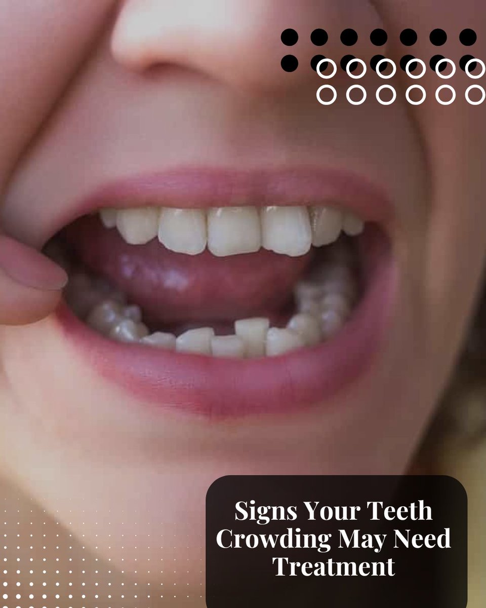 DrPinkner's tweet photo. You may benefit from treatment if you notice:
• Overlapping or rotated teeth
• Difficulty flossing between teeth
• Frequent cavities or gum irritation
• Bite discomfort https://t.co/SULauLCaZS