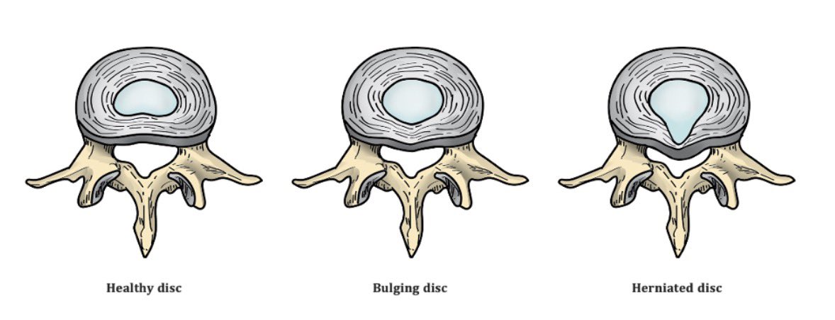 Squat University tweet media