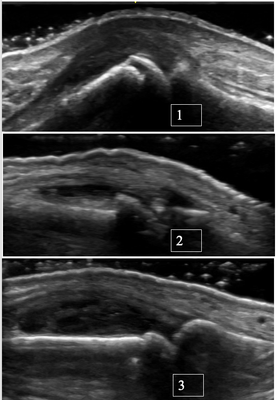 Rheumatology US Case-based Learning tweet media