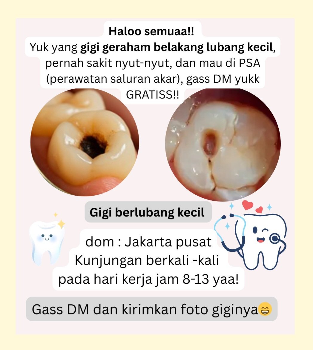 arisuuww's tweet photo. Welcome back again!

Yuk yg ada gigi belakang berlubang kecil, suka sakit tiba2, mau di PSA, kunjungan berkali2, boleh banget dm yaa! Gratisss

Kunjungan hari kerja jam 8-13 yaps🤗

📍 domisili :  jakarta pusat
#sakitgigi 
#perawatansaluranakar  #koasgigijakarta #gigiberlubang https://t.co/BJ91ZhfafM