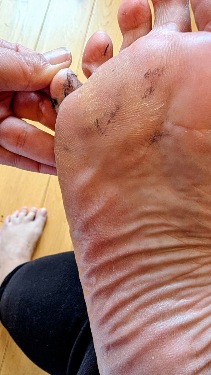 FelicitysFeet26's tweet photo. These soles need some serious attention! ๐
#FootLover #FootFetish #LittlePiggies #SmellyFeet #ToesAndSoles #FeetWorship #Solestagram #Feet #NakedFeet #FeetLovers #WrinkledSoles #BareFeet #GirlsBareFeet
@rt_feet @feetexplorerRT @Feetopia @feetparade @Feetcentral13 @FootBeauties https://t.co/CCXINidg3A