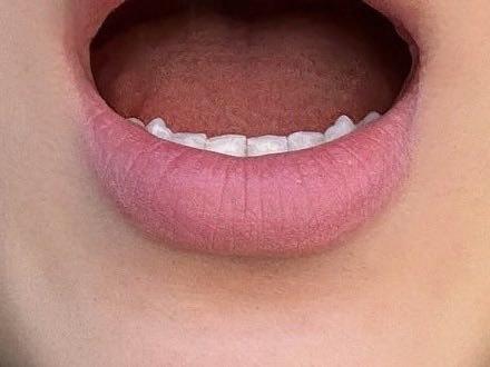 5OoooS's tweet image. 깨비아랫니ㅜㅜ