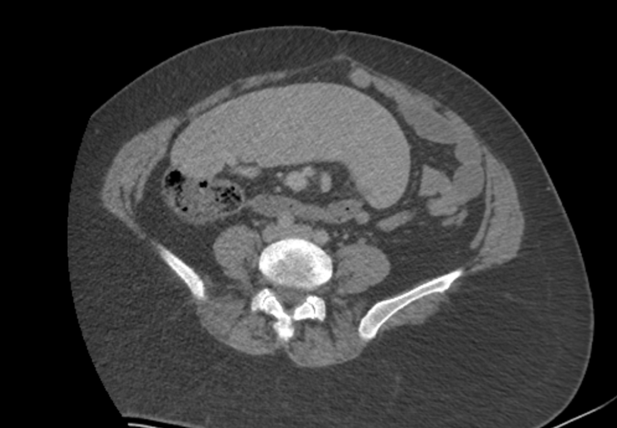 Radiology Tutorial Cases (CT,MRI) (@Ganymade__) / Posts / X