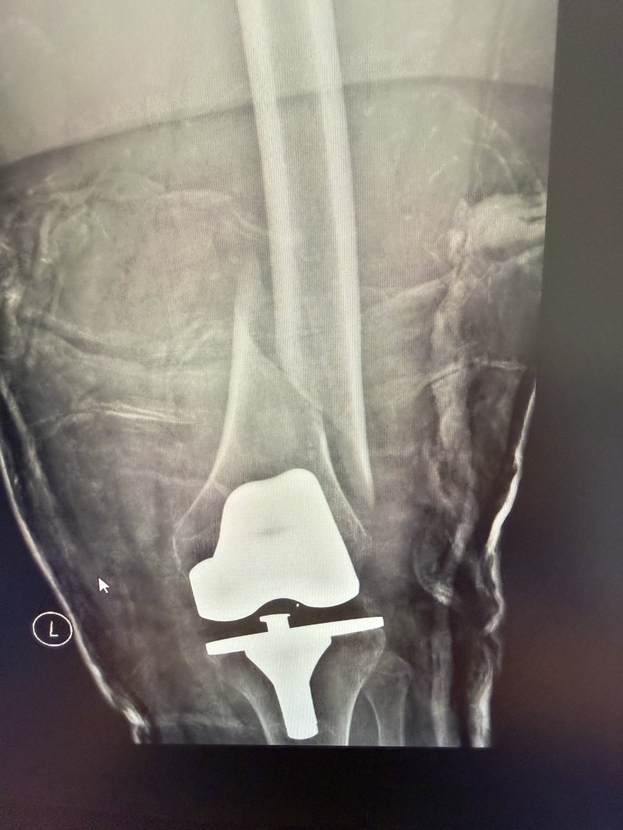 SP Orthopaedics tweet media