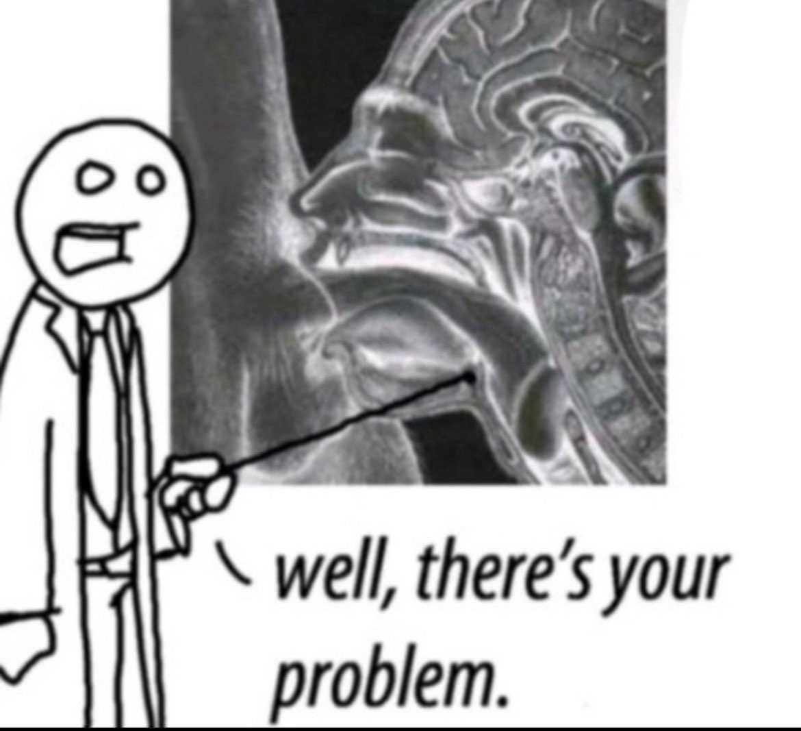 likkle67's tweet image. RT @wiinotheree: @BAEHELPJAPE @YoungboySnippet