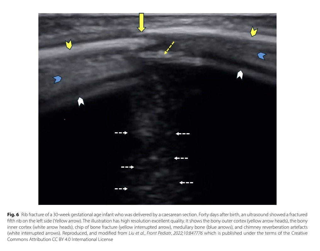 CardioMotorizado tweet media