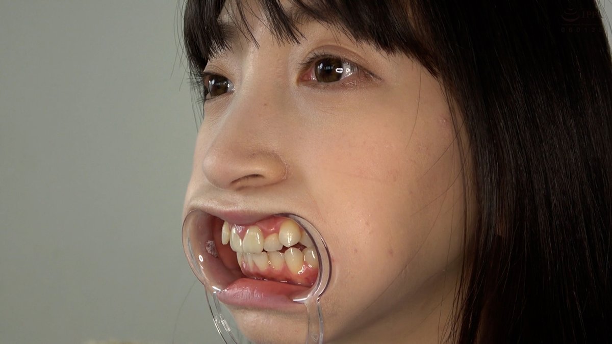 TicklingFriends's tweet photo. たまには気分を変えて、美女の口内などはいかがでしょう？
マウスオープナーを装着した顔がエロいです。
今日は、ことねんちゃんです。
※12枚のサンプル画像は↓下のURLをクリック！
https://t.co/BybSkacQcS
Let's all enjoy tickling.
@adoafechi
@abvakiba
#口内 #マウスオープナー #歯 #歯茎 #舌 https://t.co/V8WNXjF9oK