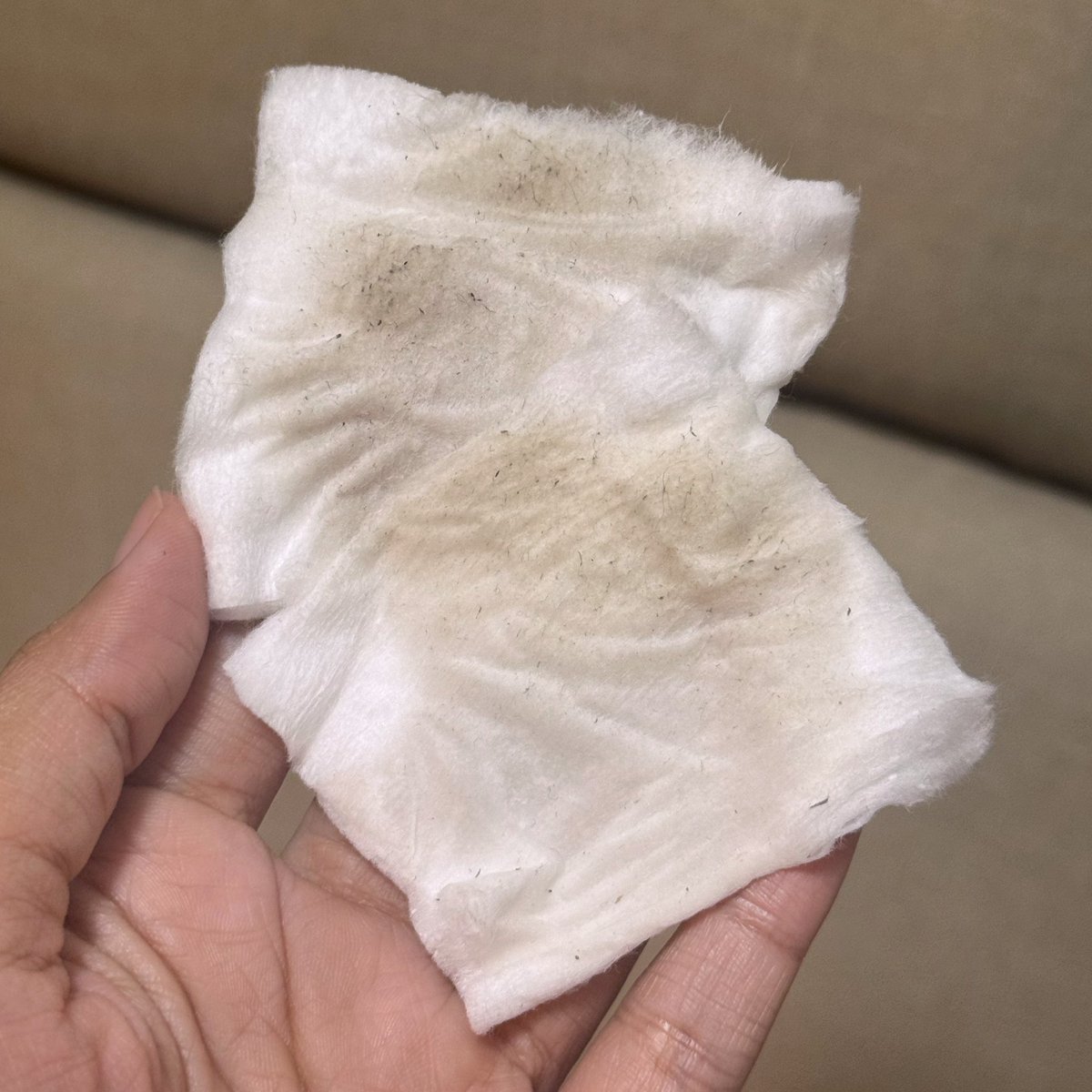 (ขออภัยในความดำนี้🥹)

ไปขุดภาพสำลีที่เช็ดรักแร้ครั้งแรกเจอในแชทที่ส่งไปอวยเพื่อนว่าตัวนี้ดีจริงง ครั้งแรกๆคือแบบนี้เลยนะ ตรงไหนดำๆด้านๆ ขยันเช็ดบอกเลยว่าสว่างเนียนขึ้นมากก ordinary ที่ 1 ในใจจ