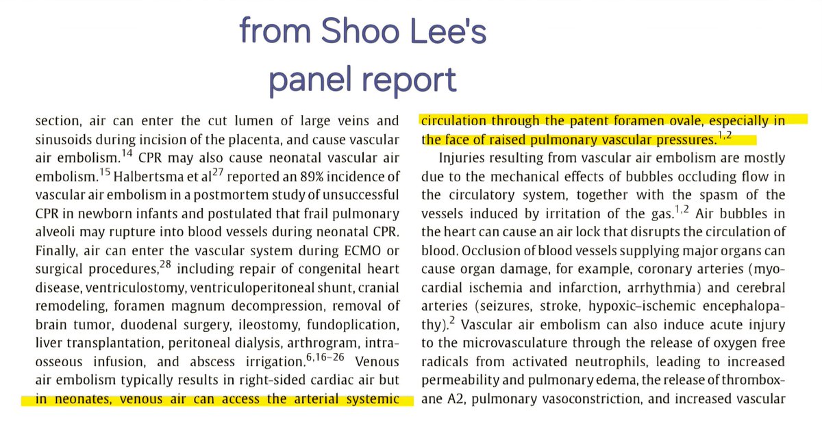 <a href="/lizhull/">Liz Hull</a> <a href="/drpaulclarke/">Paul Clarke</a> <a href="/lizhull/">Liz Hull</a> you misreport Lee's words&amp;research to the point that you state he said the total opposite of what he actually said. 

Is this deliberate? Or is it your failure to understand words &amp;not bothering to double check anything?! 

Here's Lee's report:
share.google/S9tkf9m0EZQQaU…