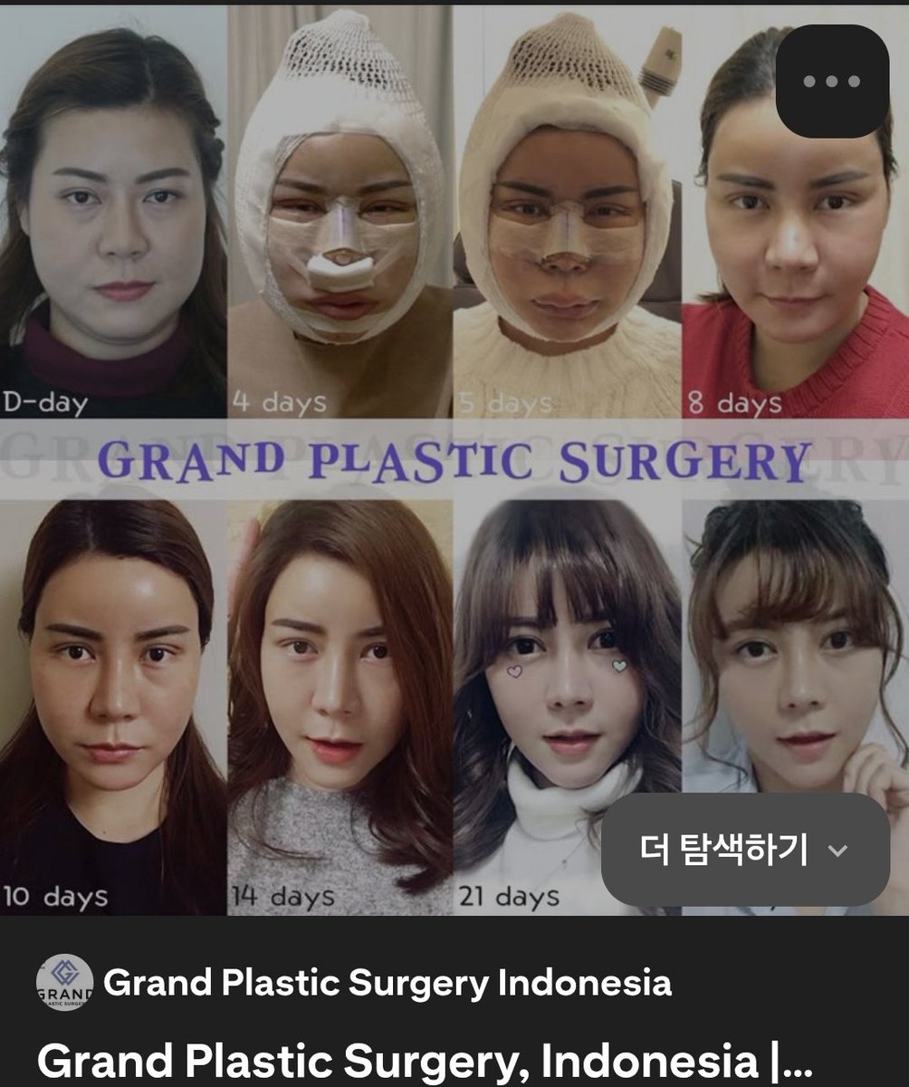 ㄹㅋ tweet media
