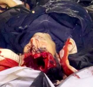 Hashshaashin's tweet photo. قول داده بودم هر روز تصاویر جنایات حکومت رو بذارم که مبادا یادمون بره، مبادا دل‌مون بسوزه، مبادا فکر کنیم آخوندها، سپاهی‌ها و بسیجی‌ها انسان هستند، مبادا انتقام فراموش بشه.

عکس روز بیستم
پیکر جاویدنامی در یکی از بیمارستان‌های تهران که سرش با احتمالا دوشکا نصف شده

#جاویدشاه https://t.co/K7q7x9wAga